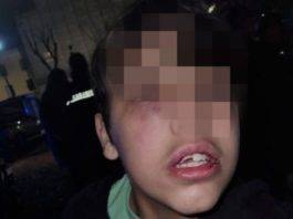 torre del greco undicenne picchiato