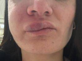 ospedale san Leonardo