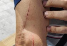 Aggredito autista di AIR Campania: il comunicato di ORSA