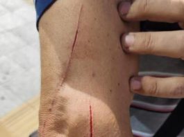 Aggredito autista di AIR Campania: il comunicato di ORSA