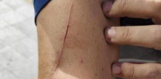 Aggredito autista di AIR Campania: il comunicato di ORSA